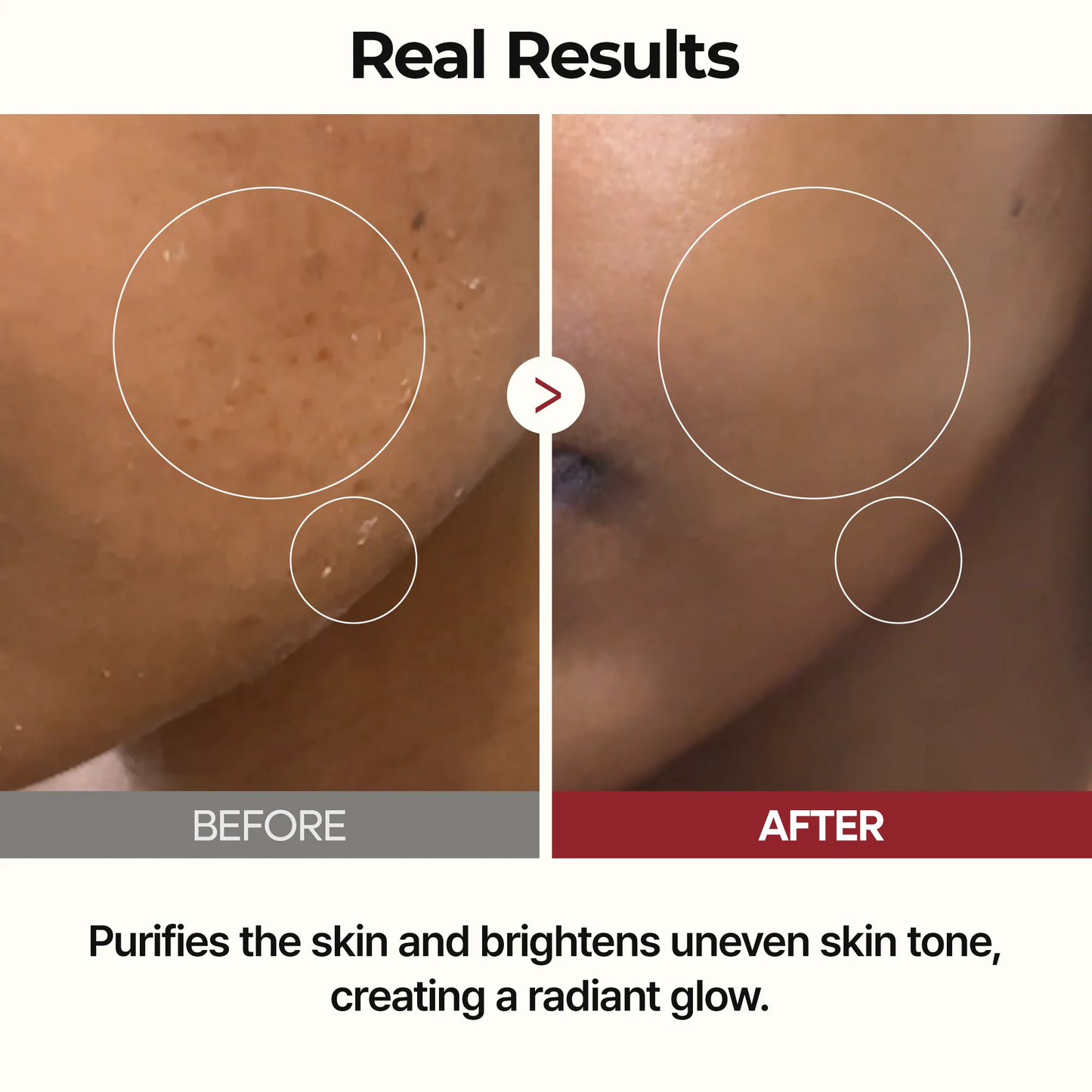 [Dr.melaxin Official]Peel Shot Glow Rice Line